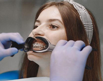How to Choose the Right Orthodontist: Key Factors to Consider