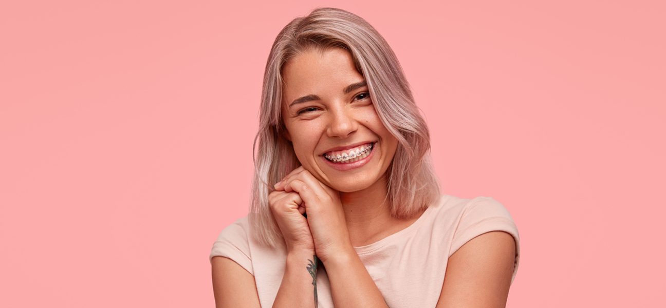 What Are the Benefits of Wearing Dental Braces in Houston
