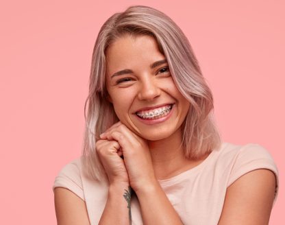 What Are the Benefits of Wearing Dental Braces in Houston 