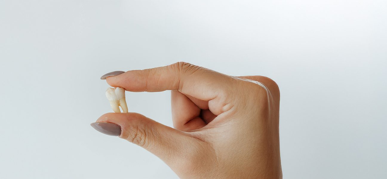 8 Tips to Help Speedy Recovery After Wisdom Tooth Extractions
