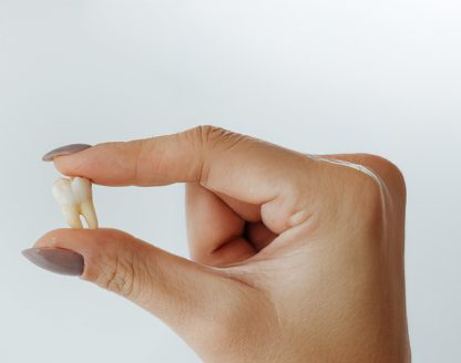 8 Tips to Help Speedy Recovery After Wisdom Tooth Extractions 