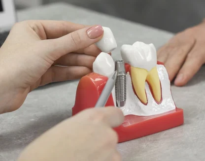 Dental Implant Failure: Causes, Signs & How to Prevent It 